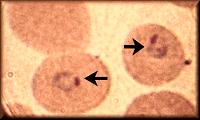 Malarial rings inside RBCs