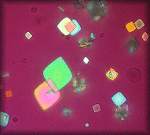 Polarized Uric Acid Crystals