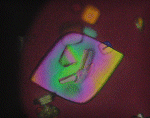 Polarized Uric Acid Crystal